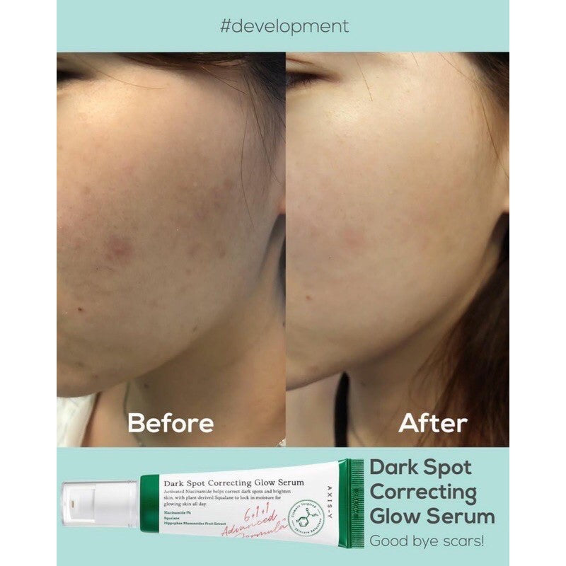 [AXIS] Y - Dark Spot Correcting Glow Serum 50mL